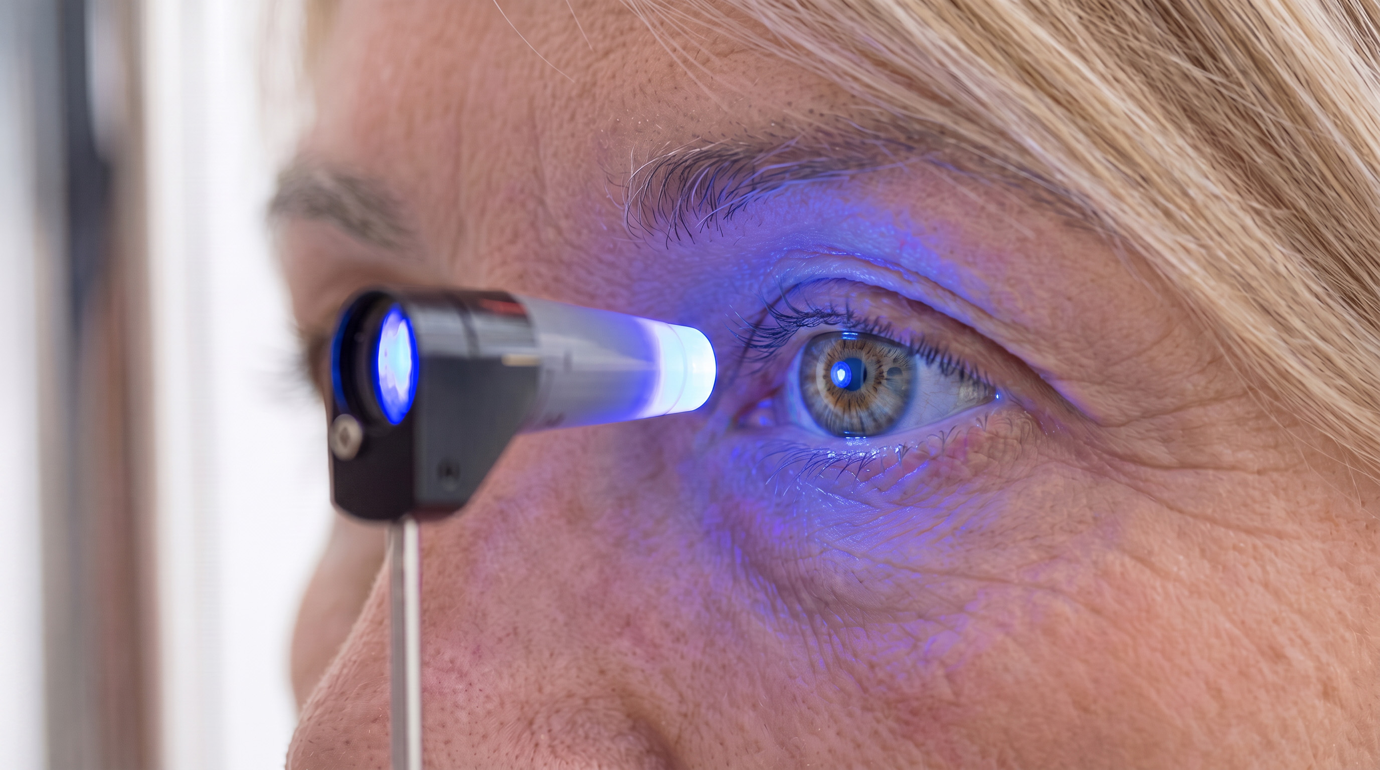 Check up de Glaucoma
